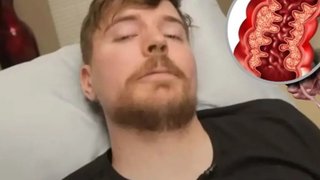 "Duele como el demonio": Qué es la enfermedad de Crohn, la afección inflamatoria intestinal que sufre MrBeast desde los 15 años